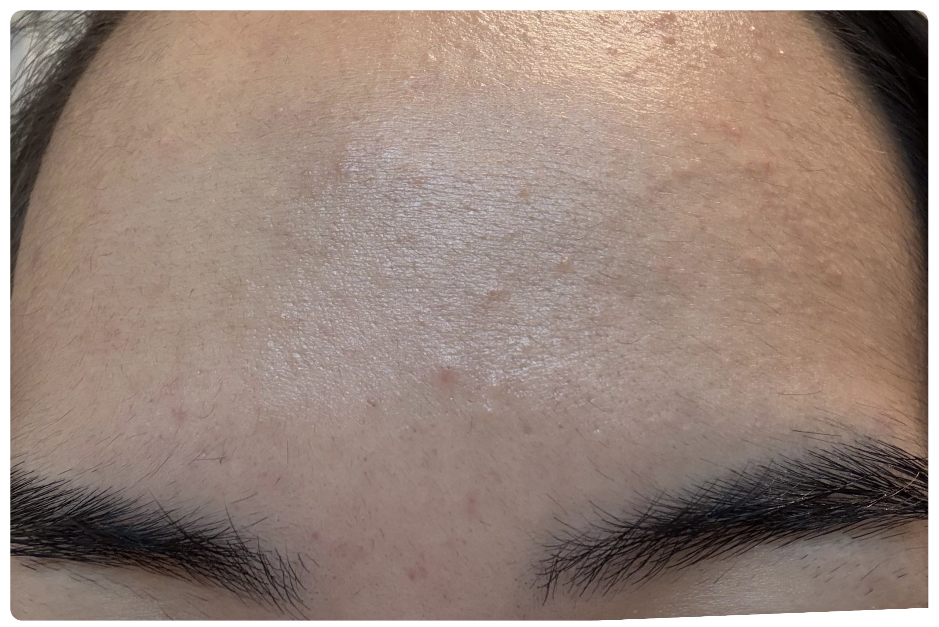 AGE-R ブースタープロ/MEDICUBE/美顔器・マッサージを使ったクチコミ（3枚目）