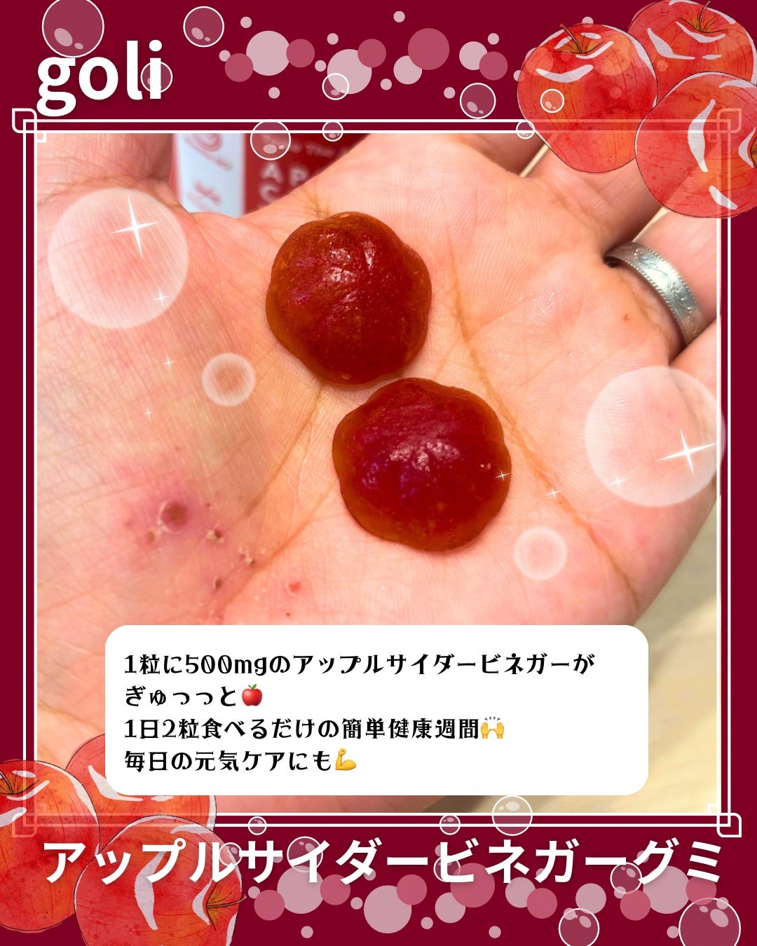 アップルサイダービネガーグミ/goli/健康サプリメントを使ったクチコミ(3枚目)
