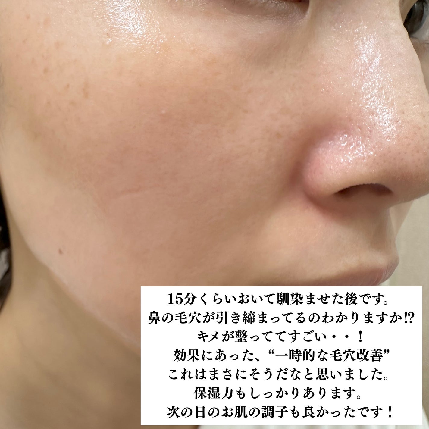 ローゼPDRNエッセンシャルマスクヘルシーグロウ/MEDIHEAL/シートマスク・パックを使ったクチコミ(4枚目)
