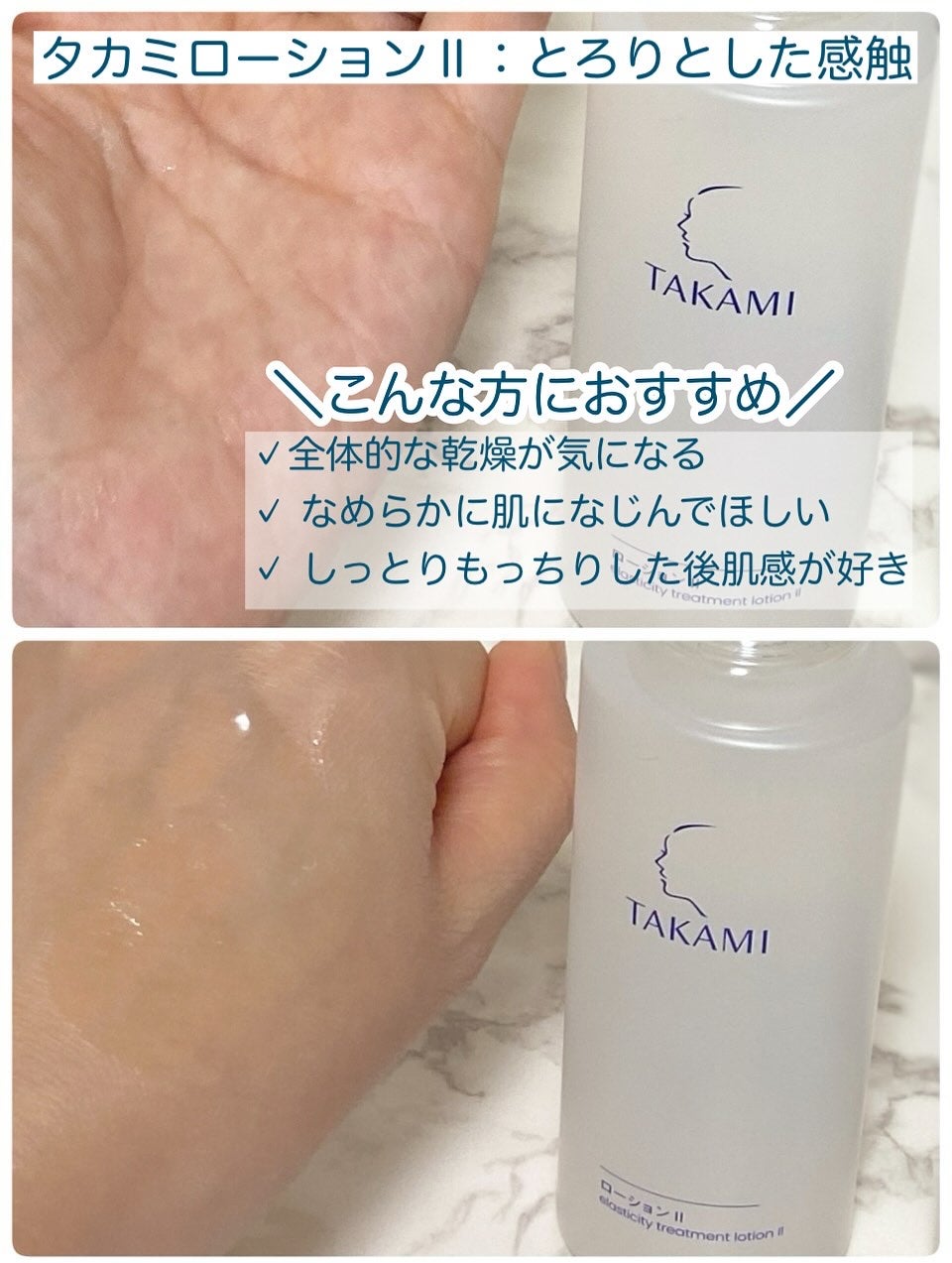 タカミローション Ⅰ/タカミ/化粧水を使ったクチコミ(3枚目)