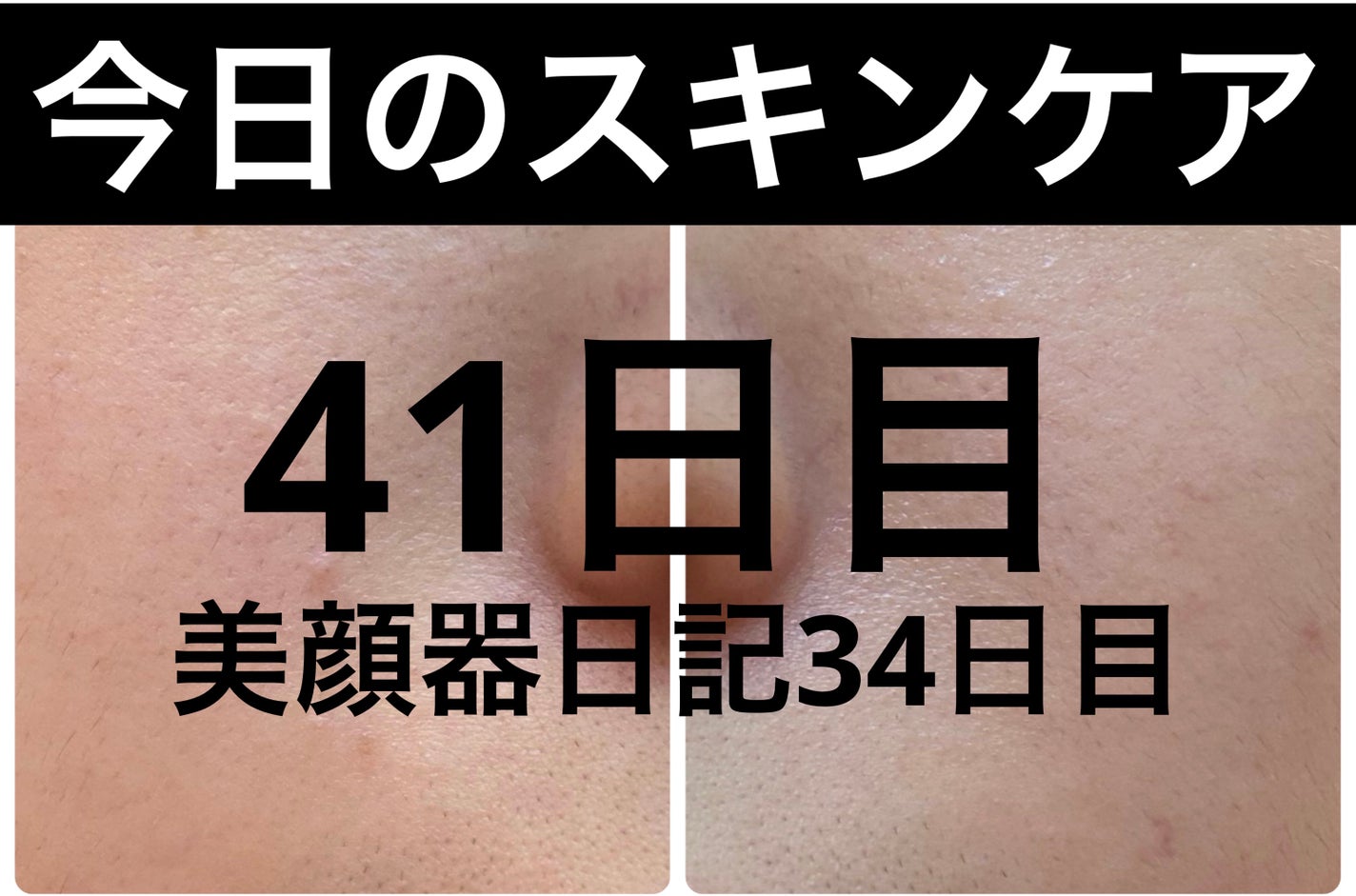 モーニングジェルウォッシュ/ビトレスキン/その他洗顔料を使ったクチコミ(1枚目)