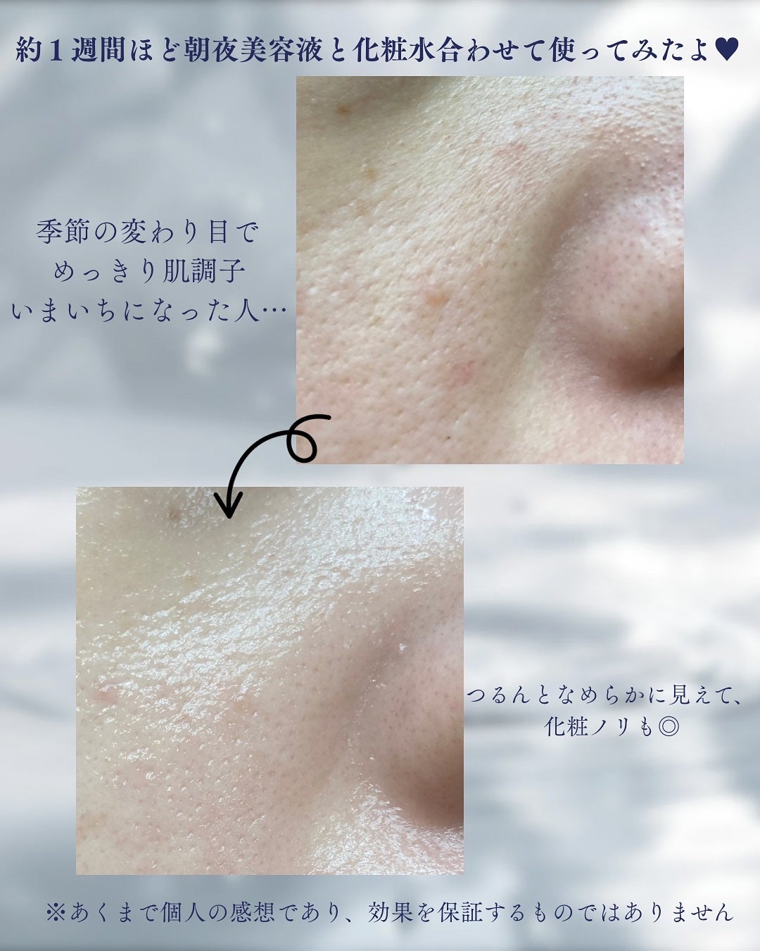 タカミスキンピール/タカミ/ブースター・導入液を使ったクチコミ(6枚目)