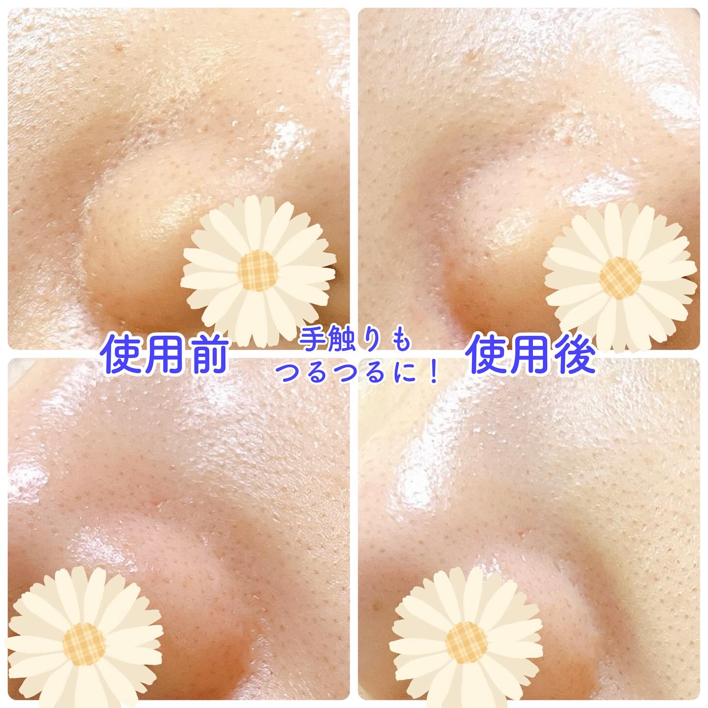 ノーモアブラックヘッド(ノーズピーリング)/One-day&#39;s you/スクラブ・ゴマージュを使ったクチコミ（3枚目）