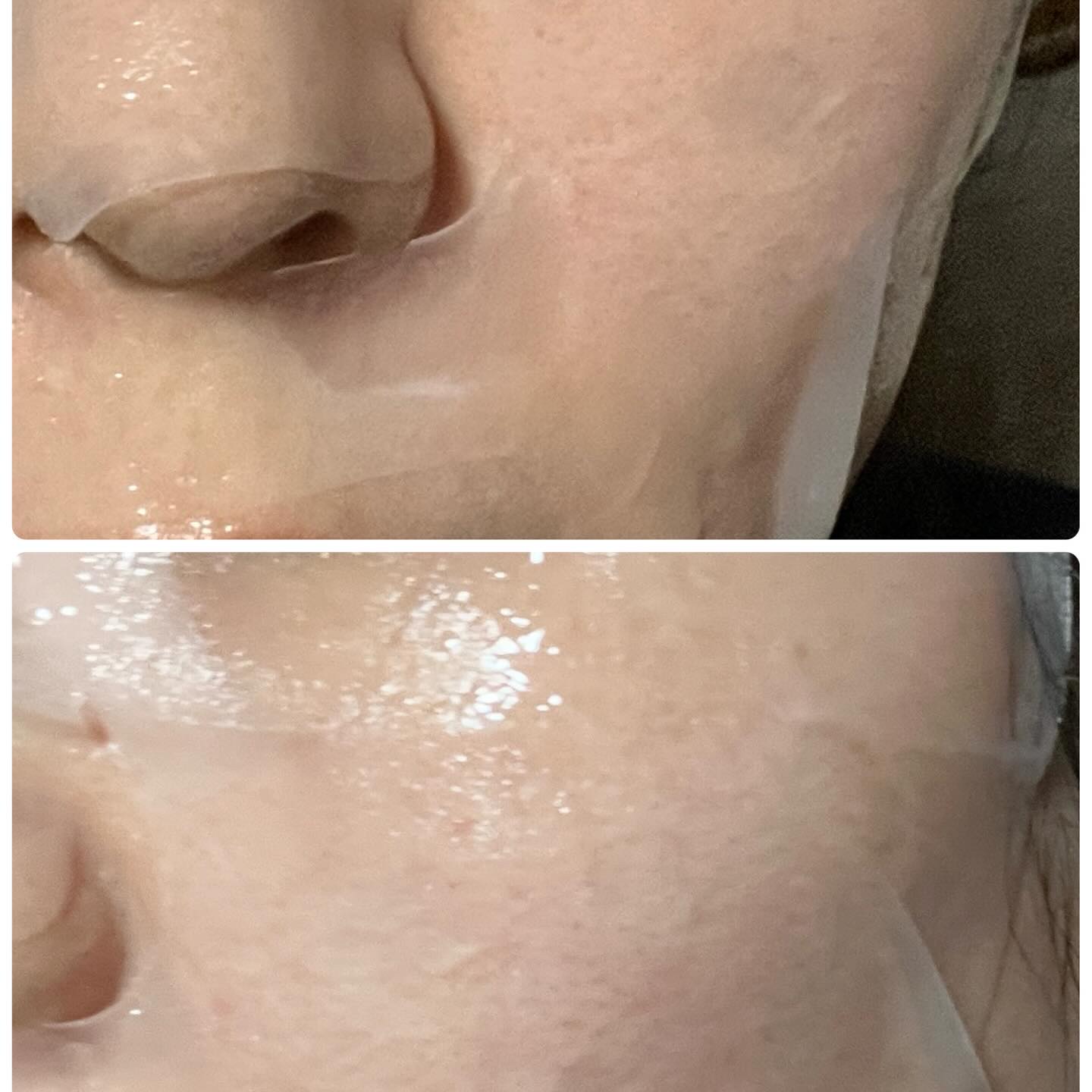 ディープメラケア マルチブライトニング マスク/Mildlab/シートマスク・パックを使ったクチコミ（3枚目）