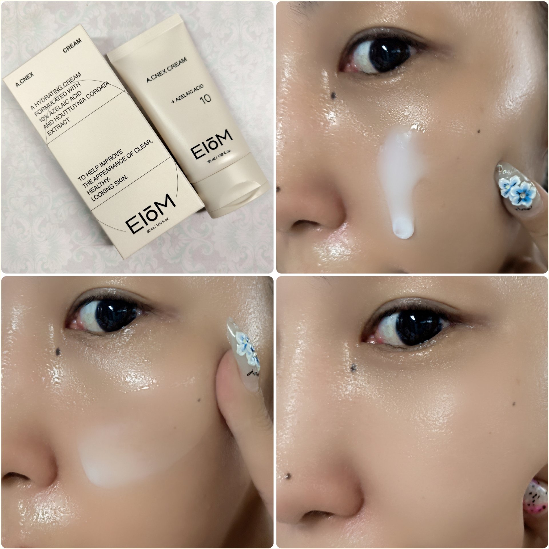 EIOM アクネクスクリーム/EIOM/フェイスクリームを使ったクチコミ（3枚目）