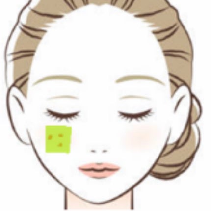 アゼライン酸15 インテンスカーミングセラム/Anua/美容液を使ったクチコミ(6枚目)