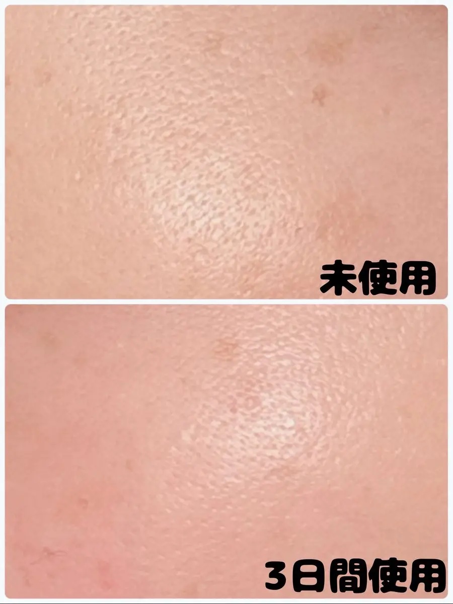 ヴィーガンAHA PHA アンプル/ureun/美容液を使ったクチコミ（3枚目）