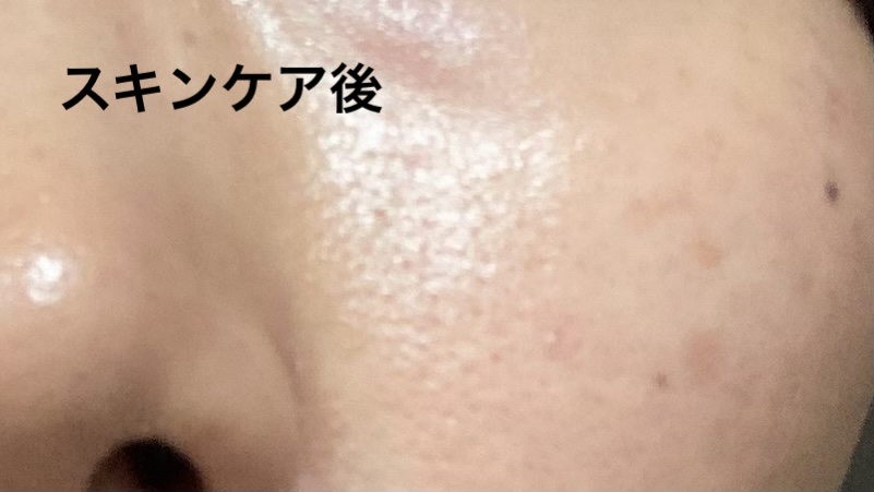 ナイアシンアミド マスク/KISO/シートマスク・パックを使ったクチコミ（1枚目）