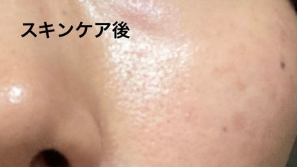 ナイアシンアミド マスク/KISO/シートマスク・パックを使ったクチコミ(1枚目)