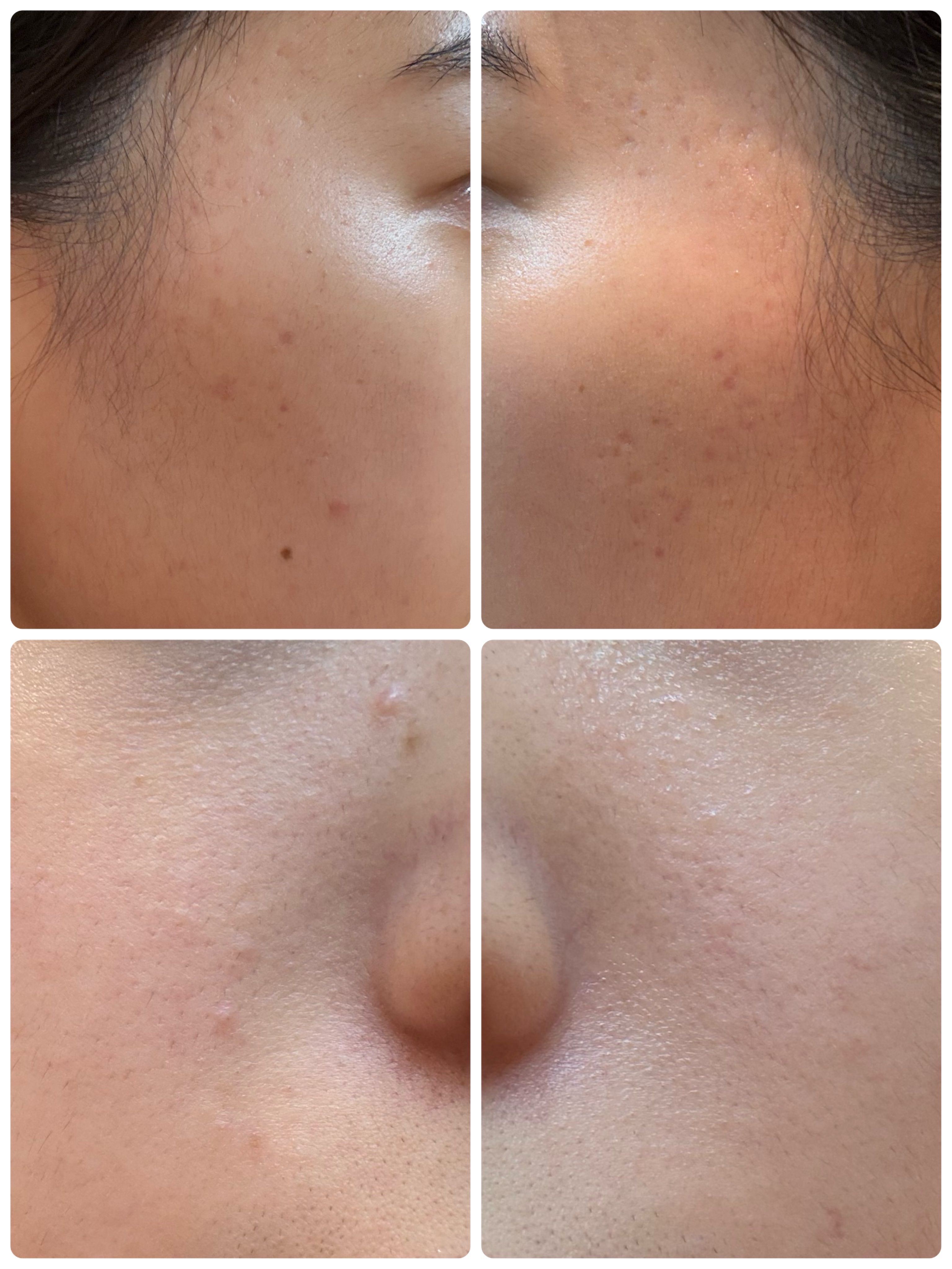 AGE-R ブースタープロ/MEDICUBE/美顔器・マッサージを使ったクチコミ（2枚目）