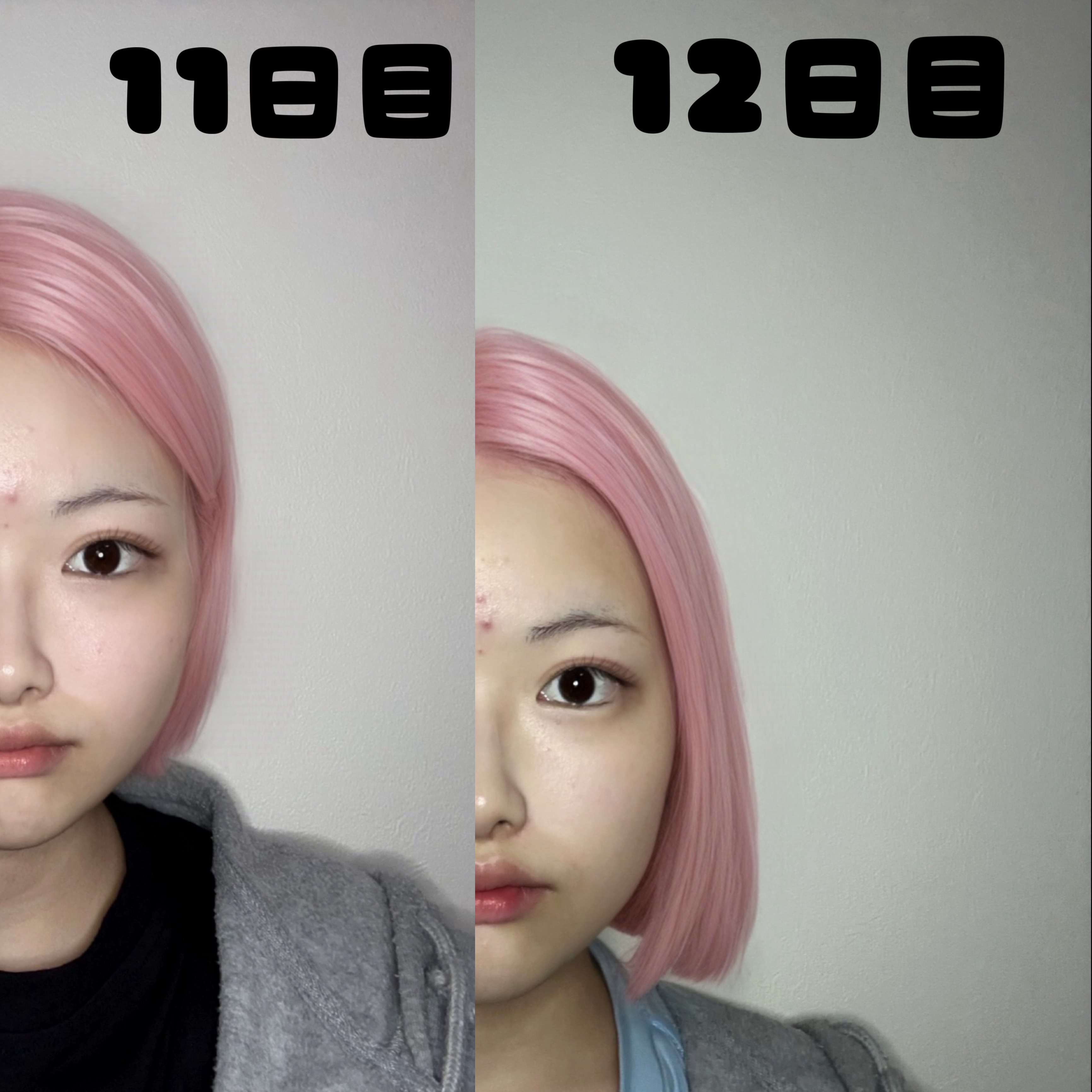 薬用しみ対策 美白化粧水/メラノCC/化粧水を使ったクチコミ（2枚目）