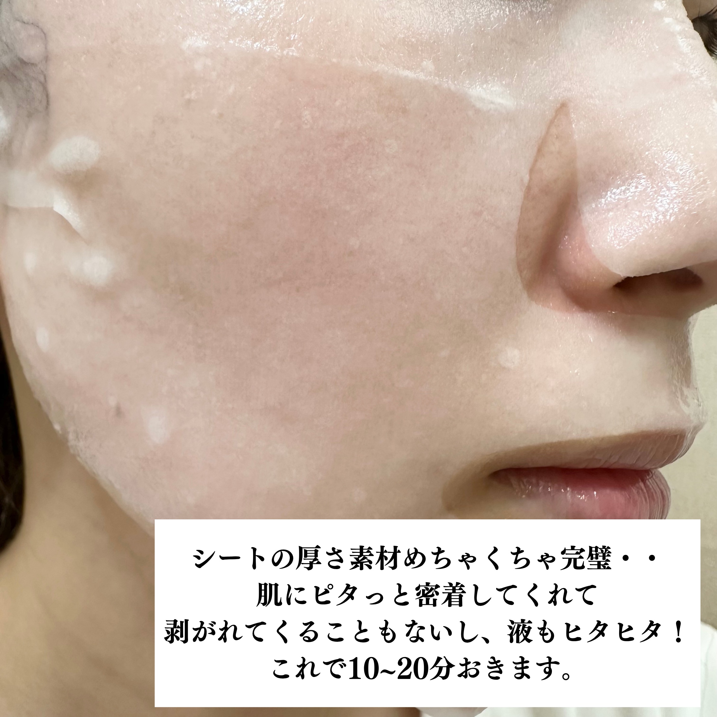 ローゼPDRNエッセンシャルマスクヘルシーグロウ/MEDIHEAL/シートマスク・パックを使ったクチコミ（3枚目）