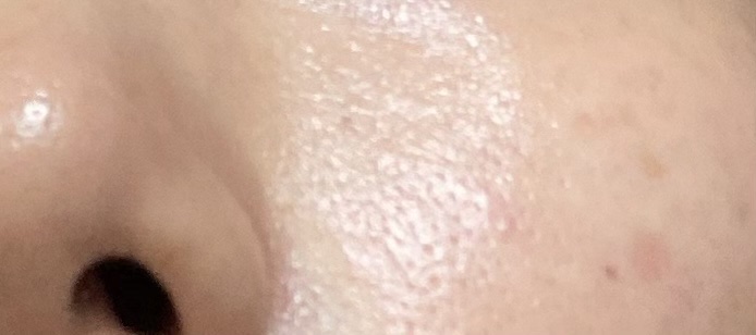 ナイアシンアミド マスク/KISO/シートマスク・パックを使ったクチコミ（2枚目）