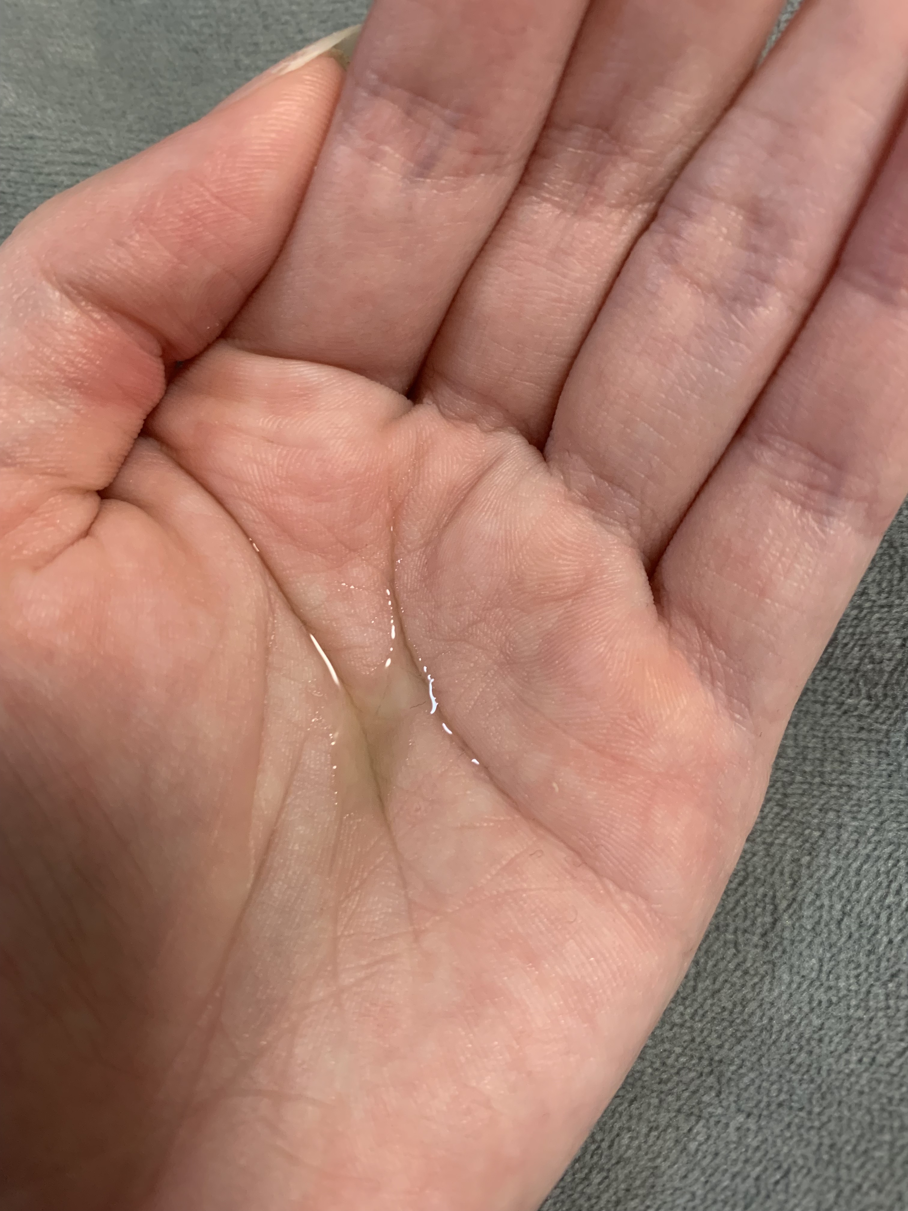 アゼライン酸17セラム/Dr.Melaxin/美容液を使ったクチコミ（2枚目）