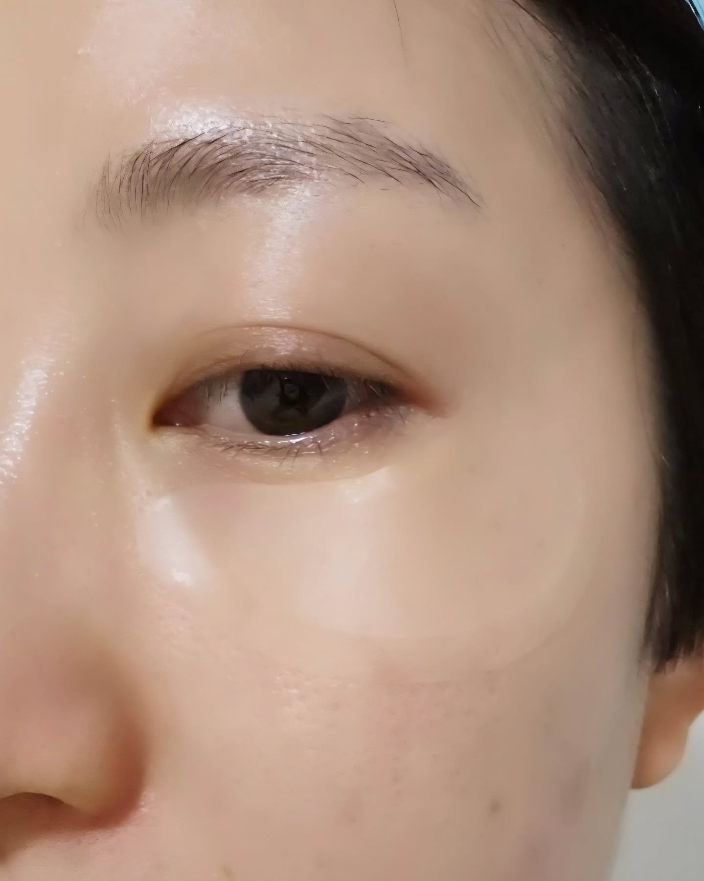 アイバックリフト1100シャットリードルパッチ/CHARDE/シートマスク・パックを使ったクチコミ（3枚目）