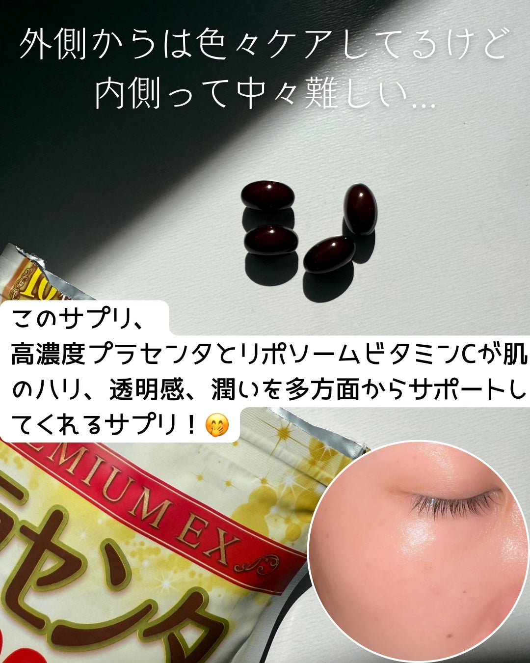プラセンタ20,000+リポソームビタミンC/マルマン/美容サプリメントを使ったクチコミ(3枚目)