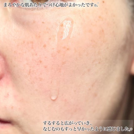 ノスカナイントラブルセラムS/FATION/美容液を使ったクチコミ(4枚目)