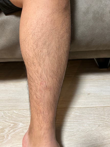 パイナップル豆乳除毛クリーム/鈴木ハーブ研究所/除毛クリームを使ったクチコミ(2枚目)