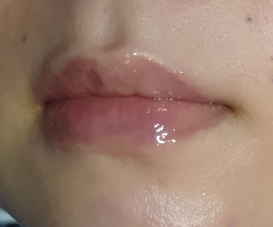 デイニードルリップ ストロング/CHOOSY/リッププランパーを使ったクチコミ(6枚目)