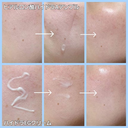 ハイドラAアンプル/Dr.lonnie/美容液を使ったクチコミ(4枚目)