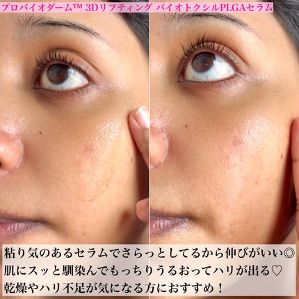 バイオヒールボ プロバイオダーム 3Dリフティングクリーム/BIOHEAL BOH/フェイスクリームを使ったクチコミ(5枚目)