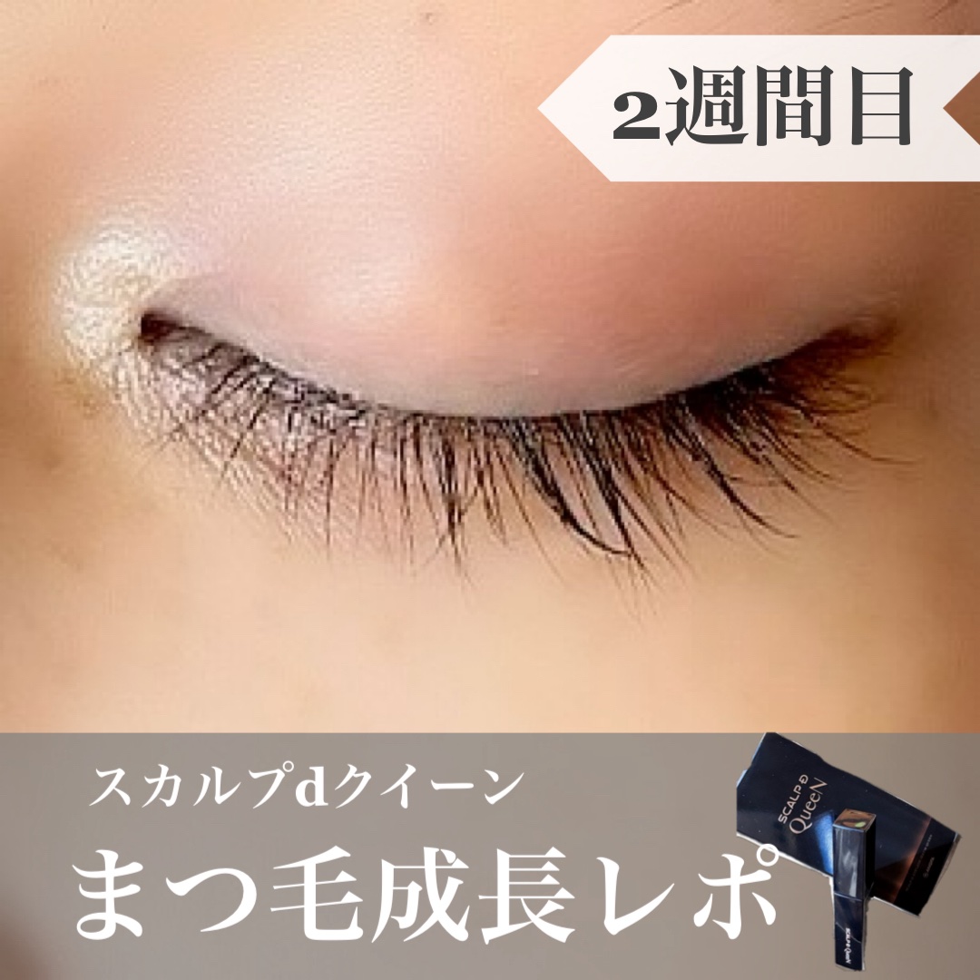 

✨スカルプDまつ毛美容液クイーン✨
2週間続けてみた感想＆経過レポです✍️

今回もとにかく朝晩しっかり塗って
まつ毛は極力ビューラーやマスカラを避けて
まつ育に力を入れてみました👀

その結果…
→両方ともにまつ毛が濃くしっかりと
