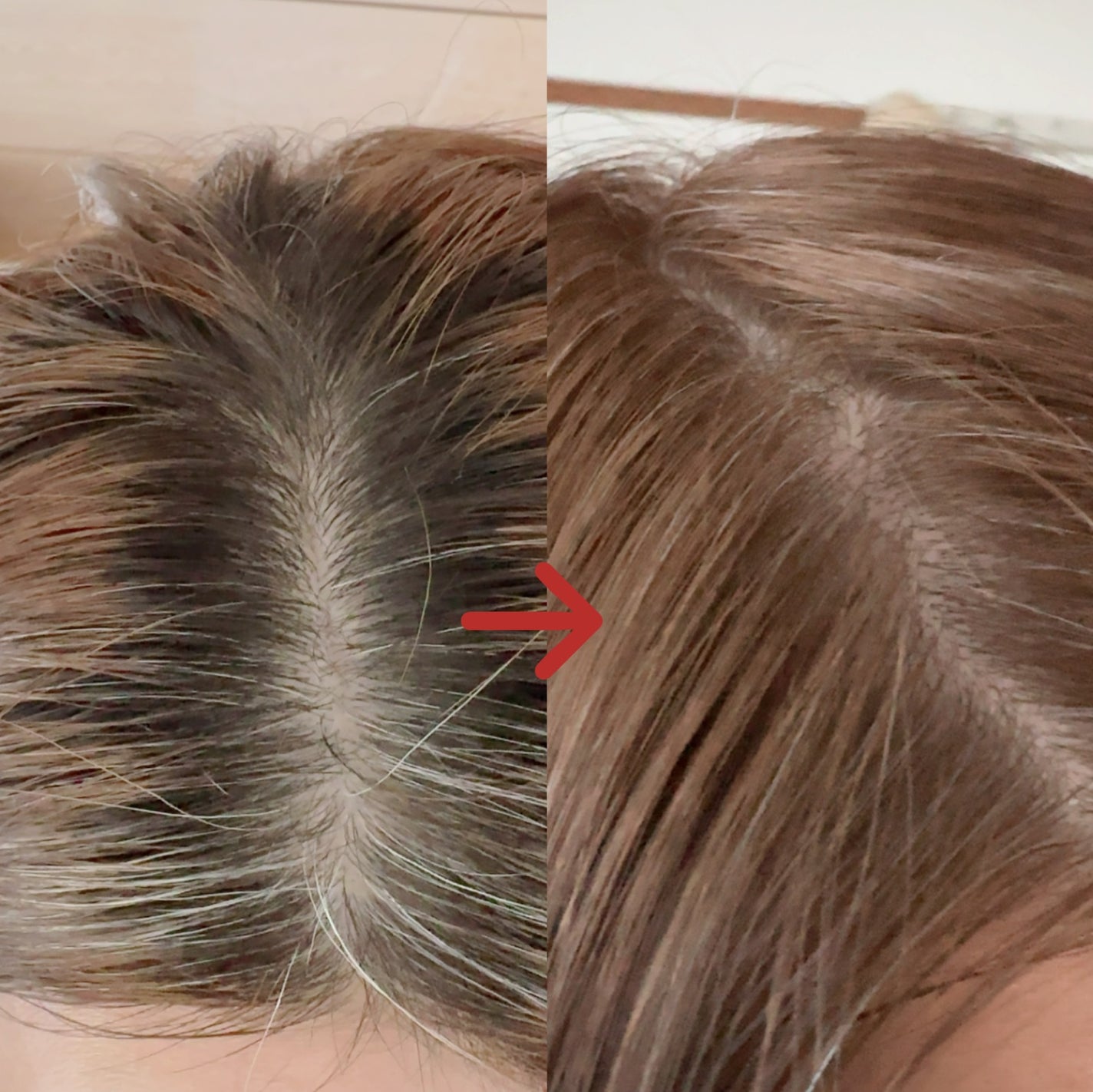 泡カラー/リーゼ/ヘアカラーを使ったクチコミ(6枚目)