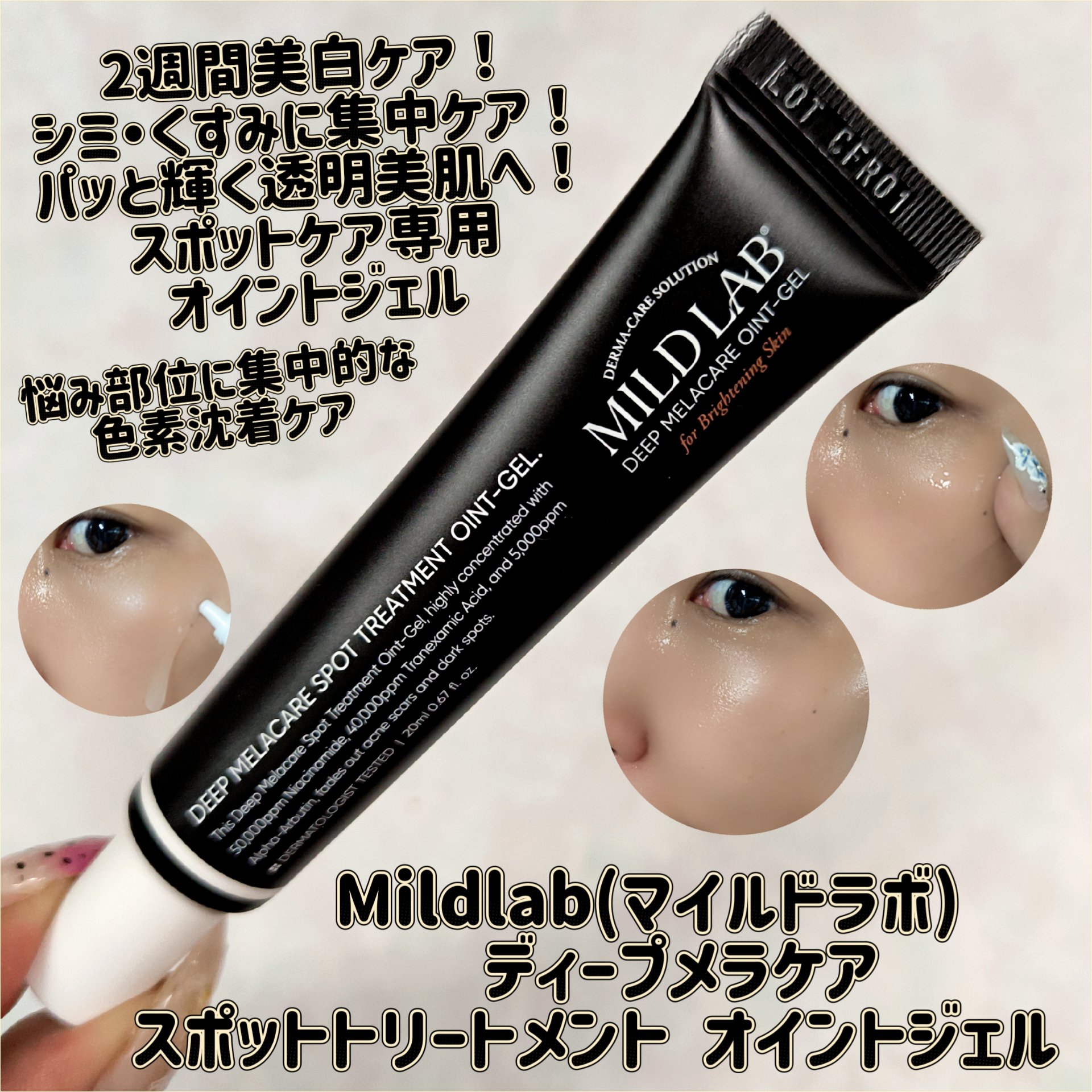 ディープメラケア スポットトリートメント オイントジェル/Mildlab/フェイスクリームを使ったクチコミ（1枚目）