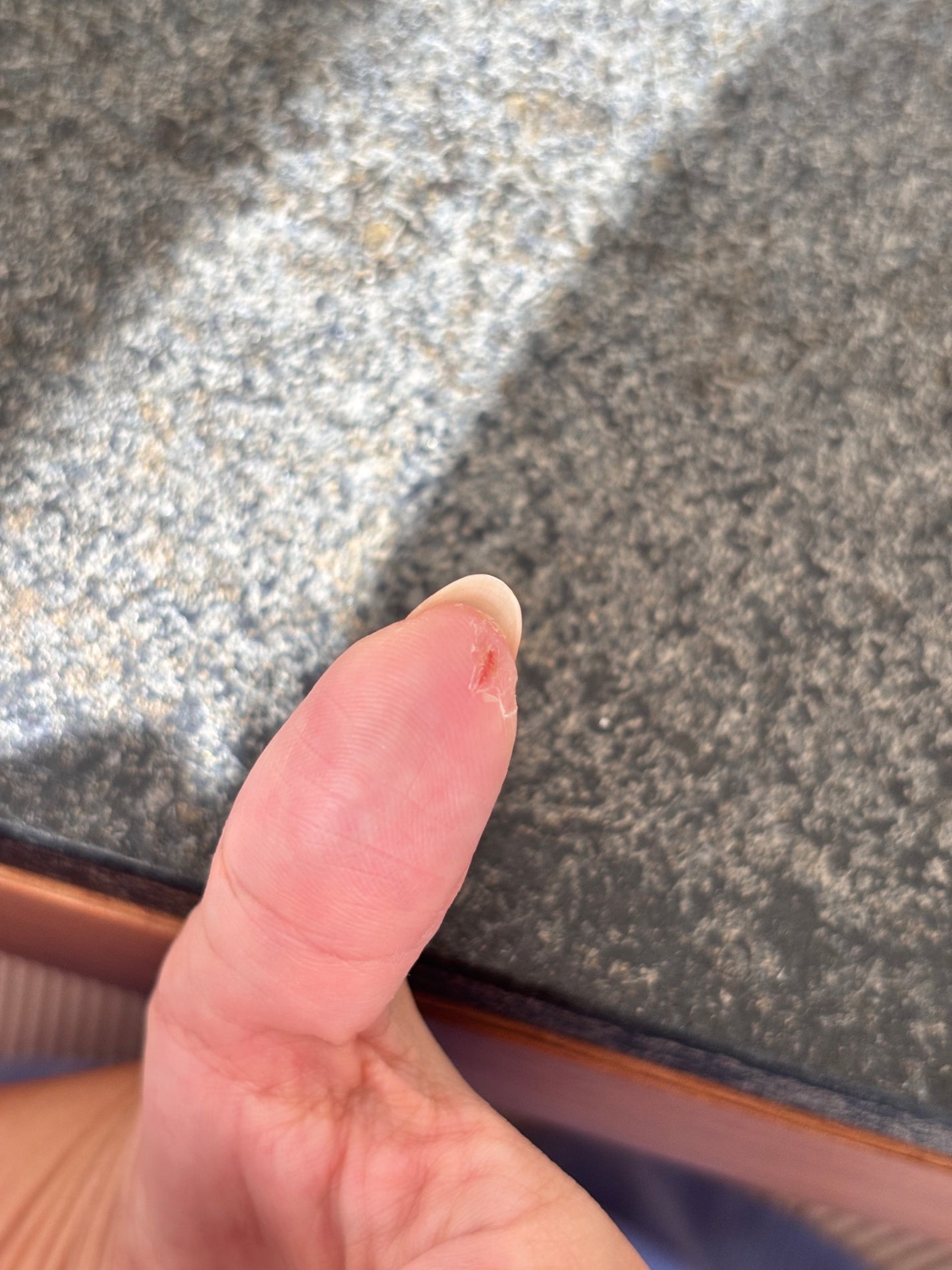 e on LIPS 「親指にひび割れができて地味に痛い。色んな作業がしにくくて、、お..」(1枚目)