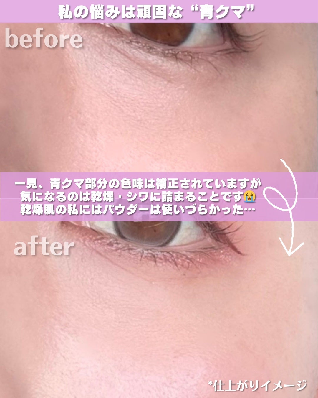 クマメンテパウダー/muice/パウダーコンシーラーを使ったクチコミ(4枚目)