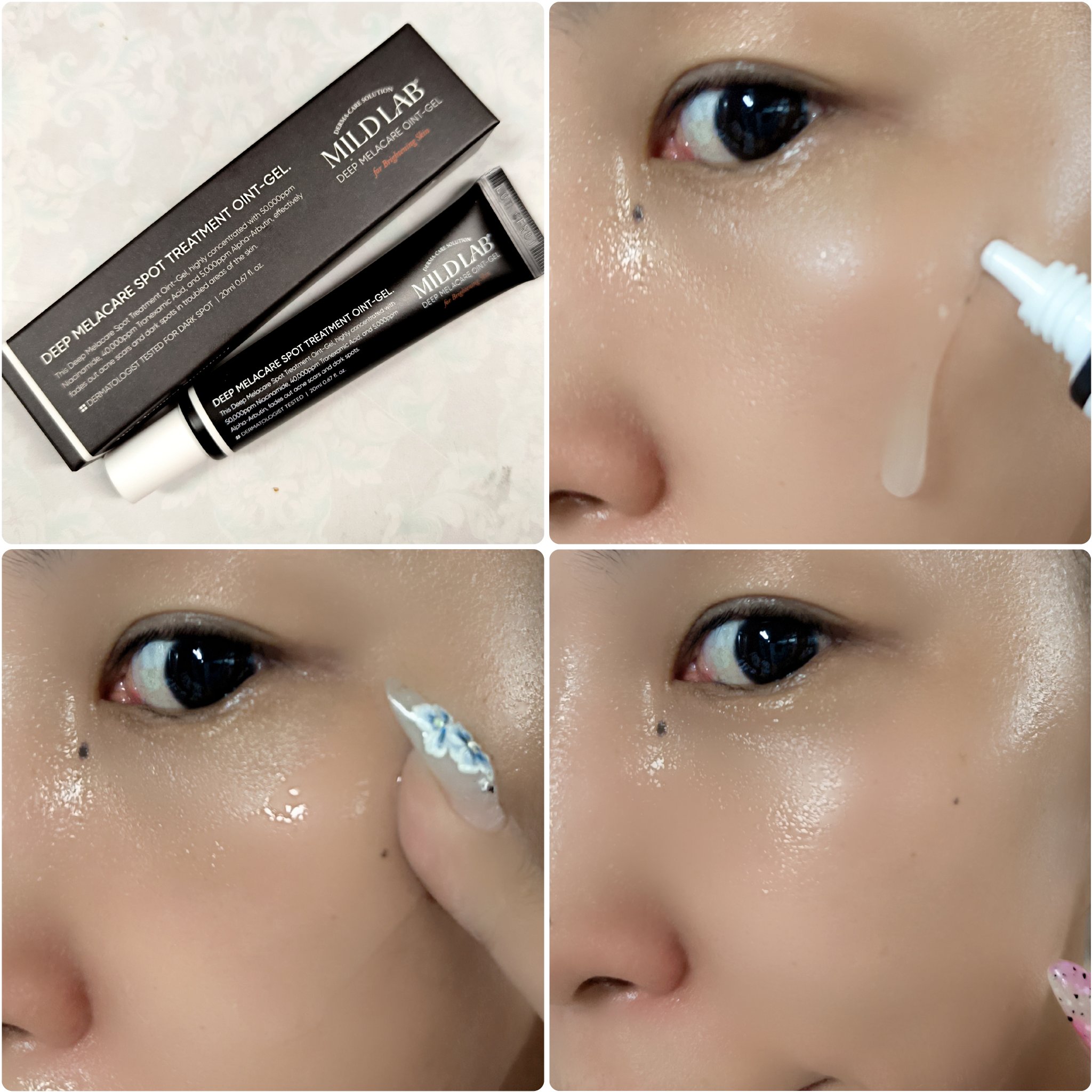 ディープメラケア スポットトリートメント オイントジェル/Mildlab/フェイスクリームを使ったクチコミ（3枚目）