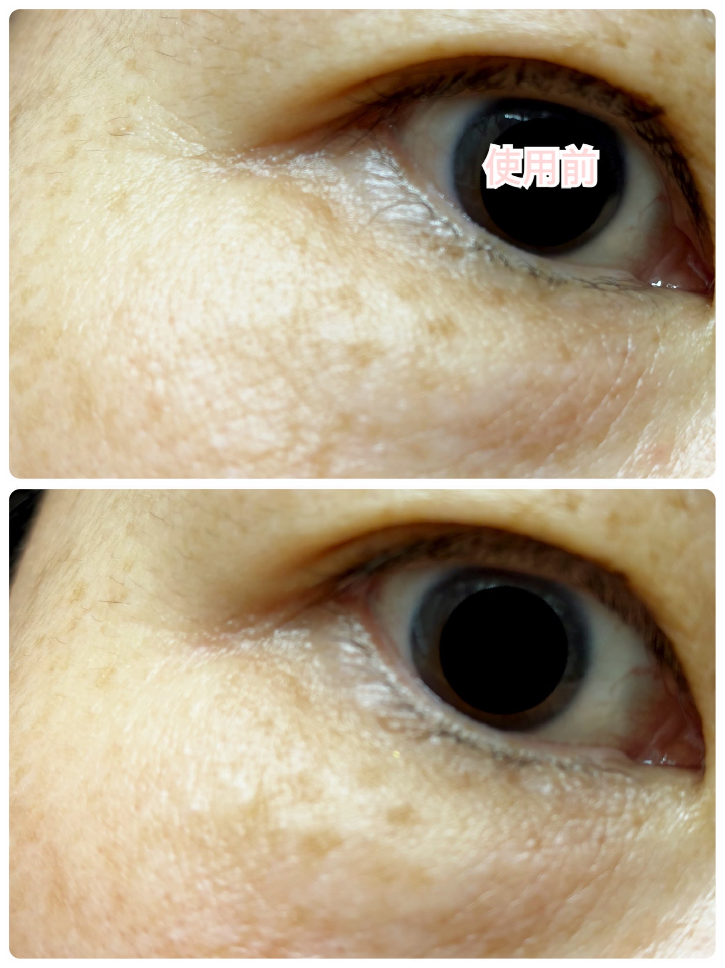 C×AZ ダーマインショット200/ESIENCE/美容液を使ったクチコミ(2枚目)