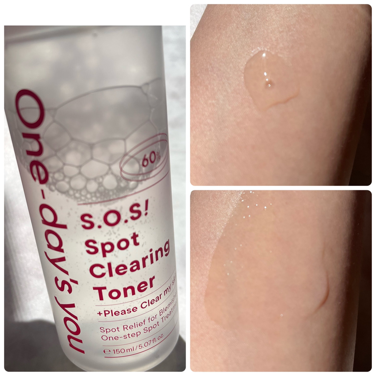 SOSスポットクリアトナー/One-day&#39;s you/化粧水を使ったクチコミ（2枚目）