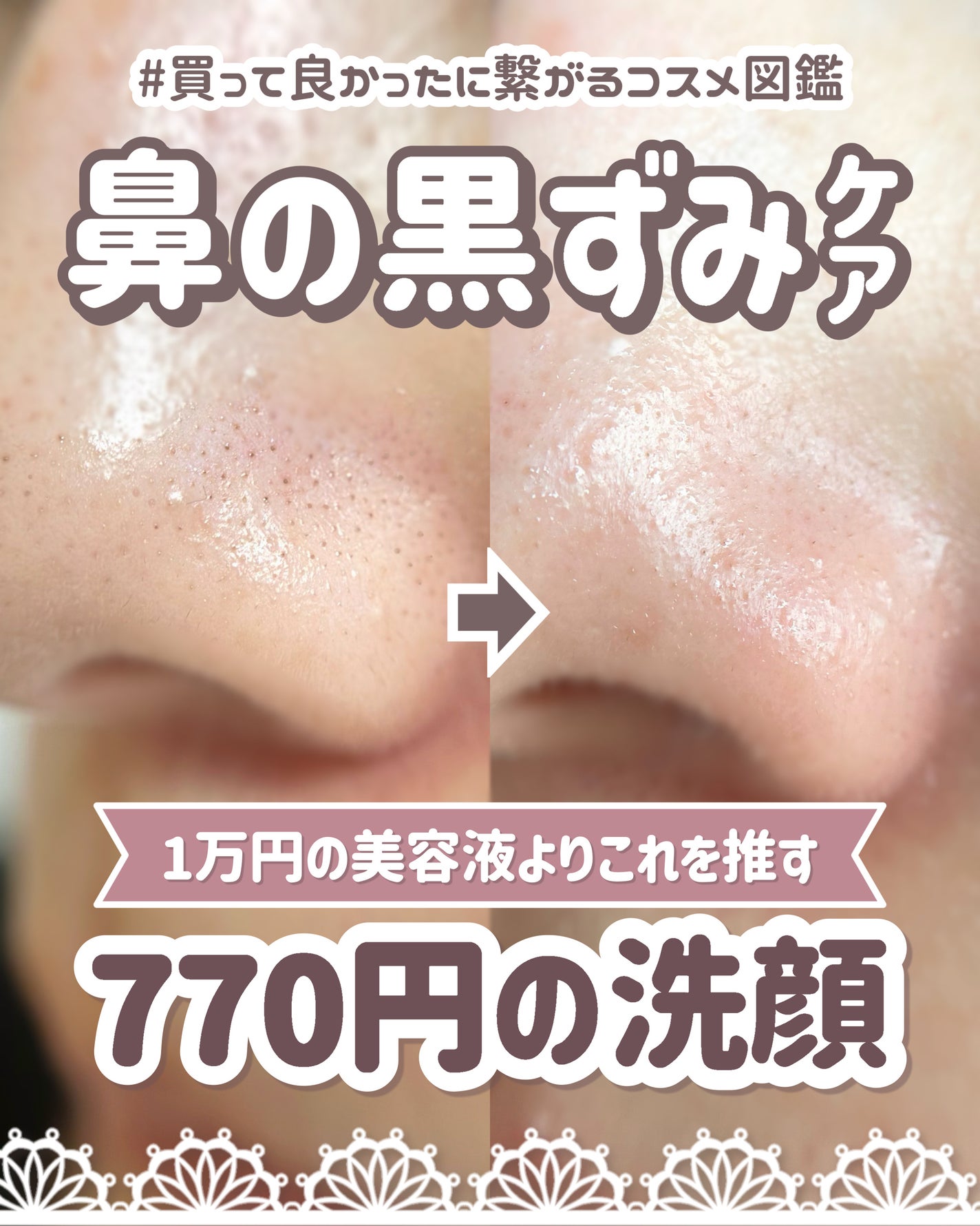 ガスール固形/ナイアード/洗顔フォームを使ったクチコミ(1枚目)