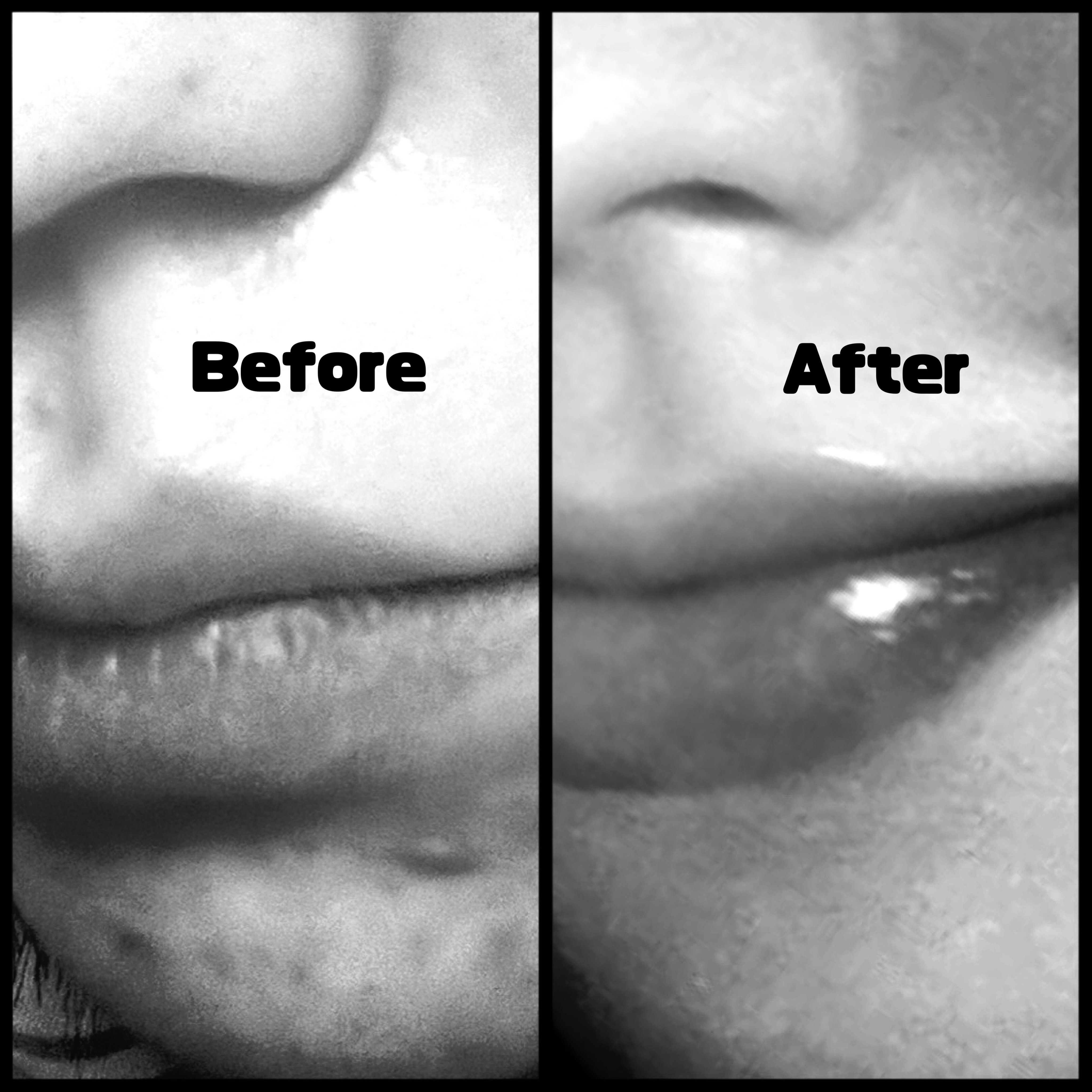 肌美精　　大人のニキビ対策 薬用クリア洗顔料　 [医薬部外品]/肌美精/洗顔フォームを使ったクチコミ（3枚目）