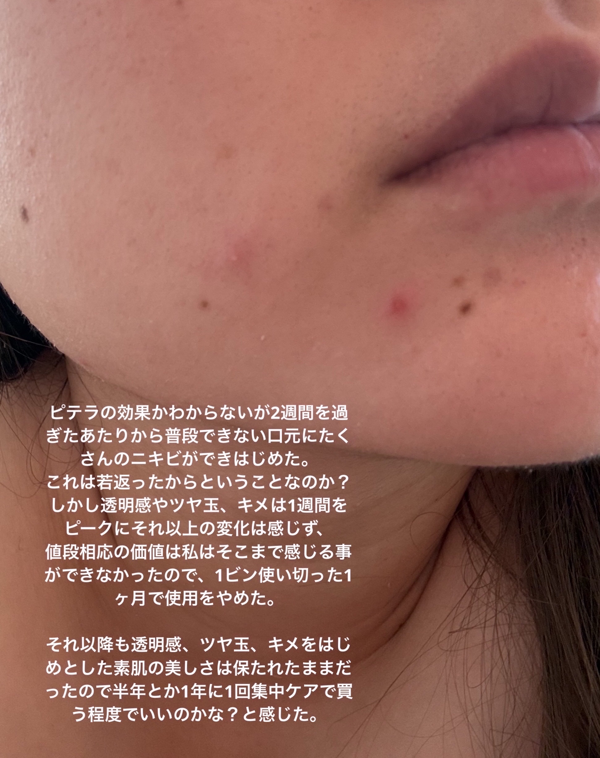 フェイシャル トリートメント エッセンス/SK-II/化粧水を使ったクチコミ（3枚目）