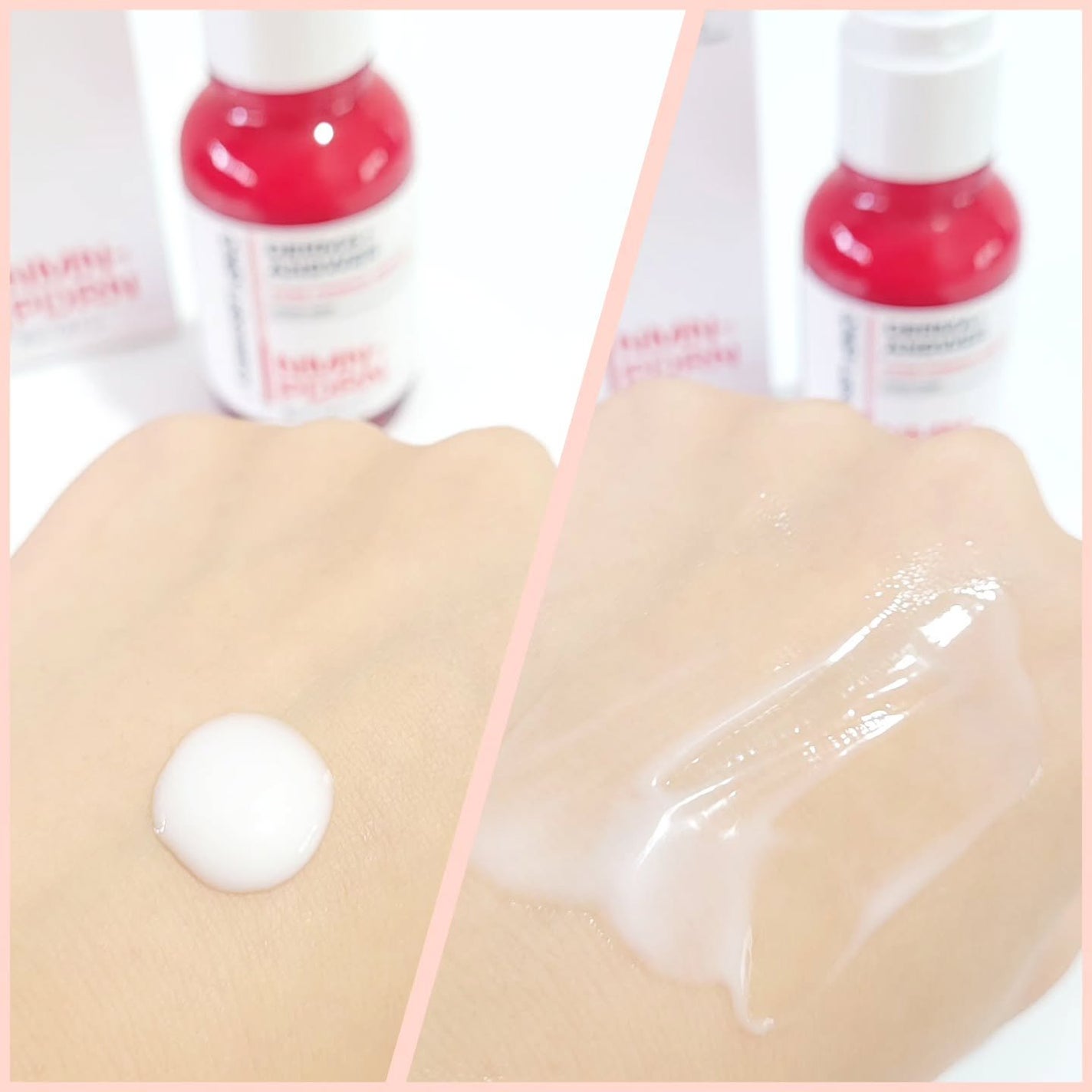 harumama.1117 on LIPS 「@lgbeauty_jpNMN-PDRNダーマアンサーポアファ..」(2枚目)