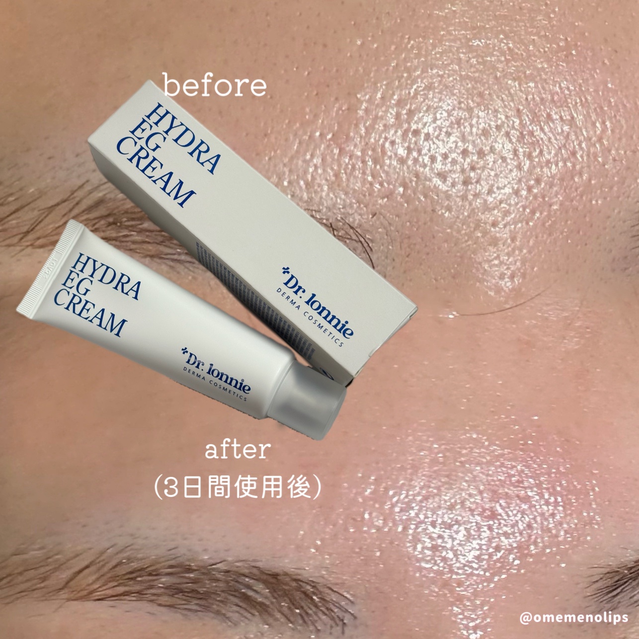 ハイドラEGクリー ム/Dr.lonnie/フェイスクリームを使ったクチコミ（3枚目）