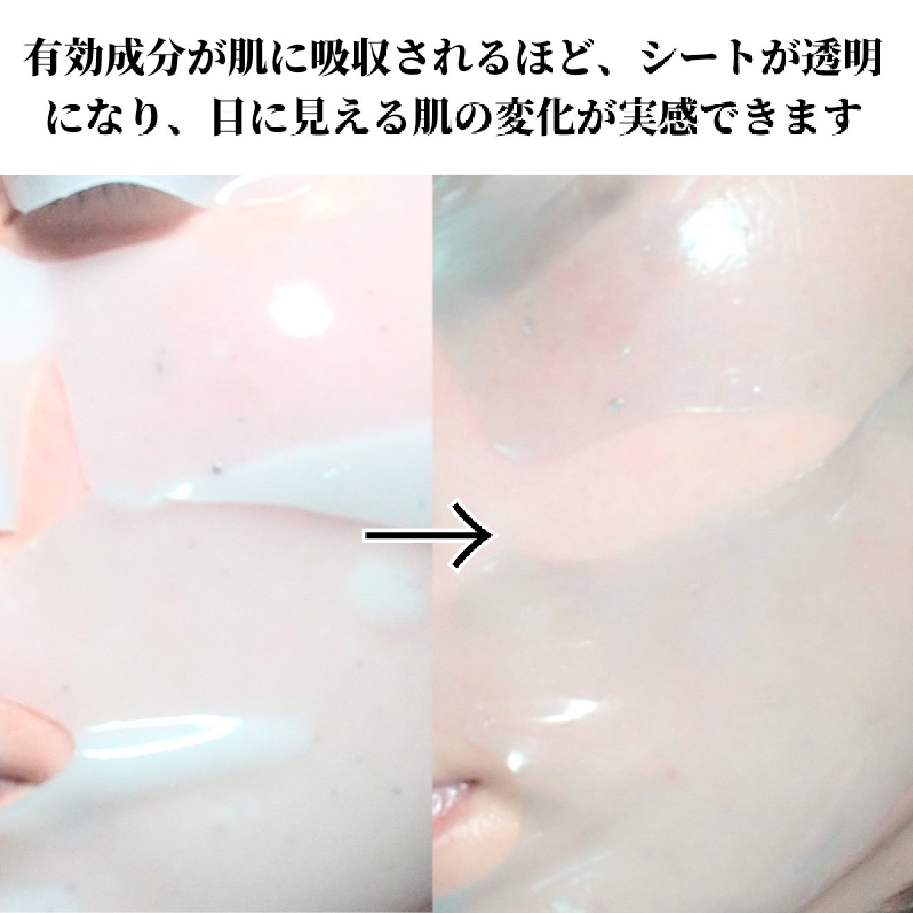 HydroB5 スキンマグネットマスク/Dr.nineteen/シートマスク・パックを使ったクチコミ（2枚目）