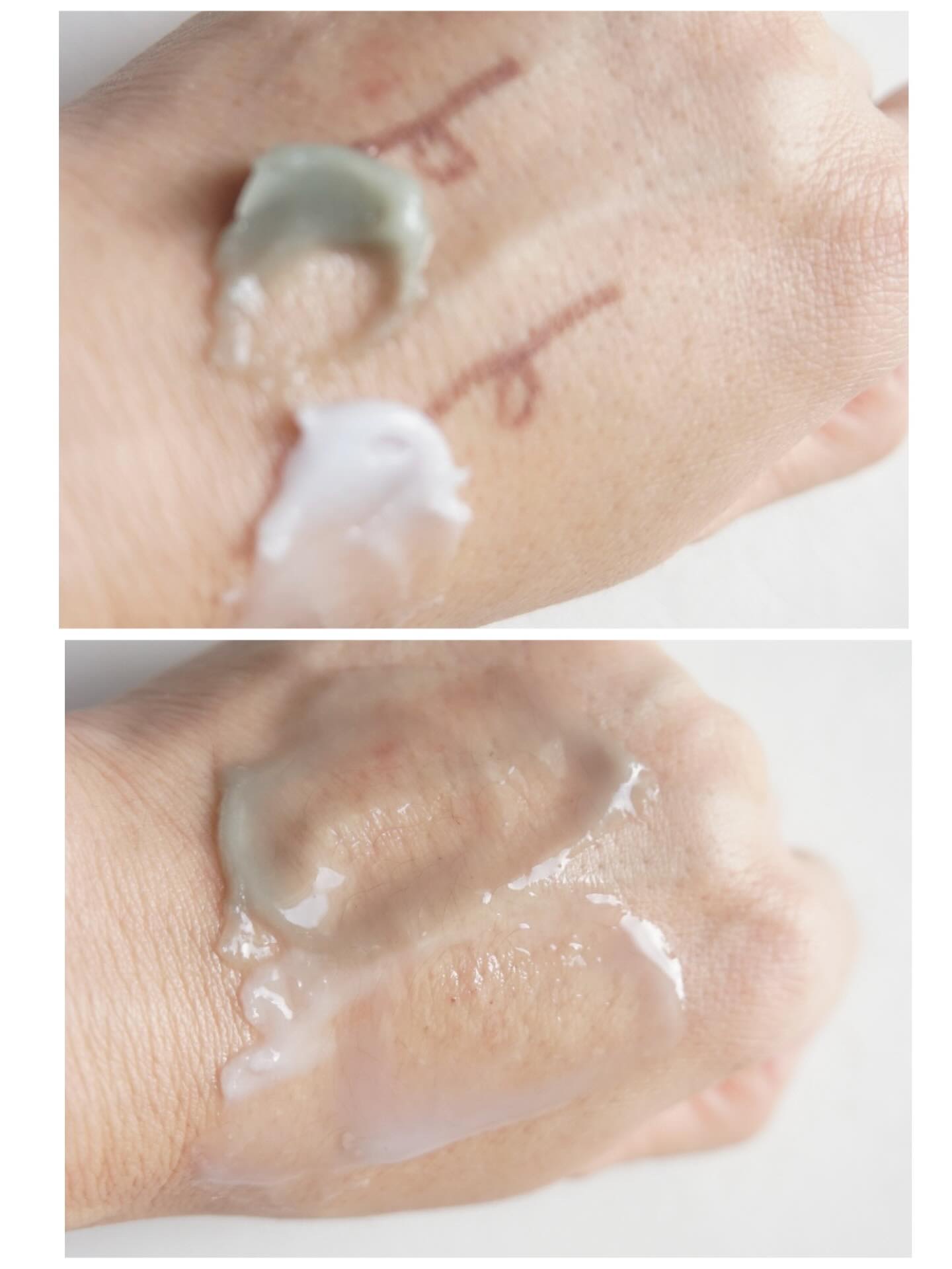 夢みるバーム アクネクリアモイスチャー/ロゼット/クレンジングバームを使ったクチコミ（3枚目）