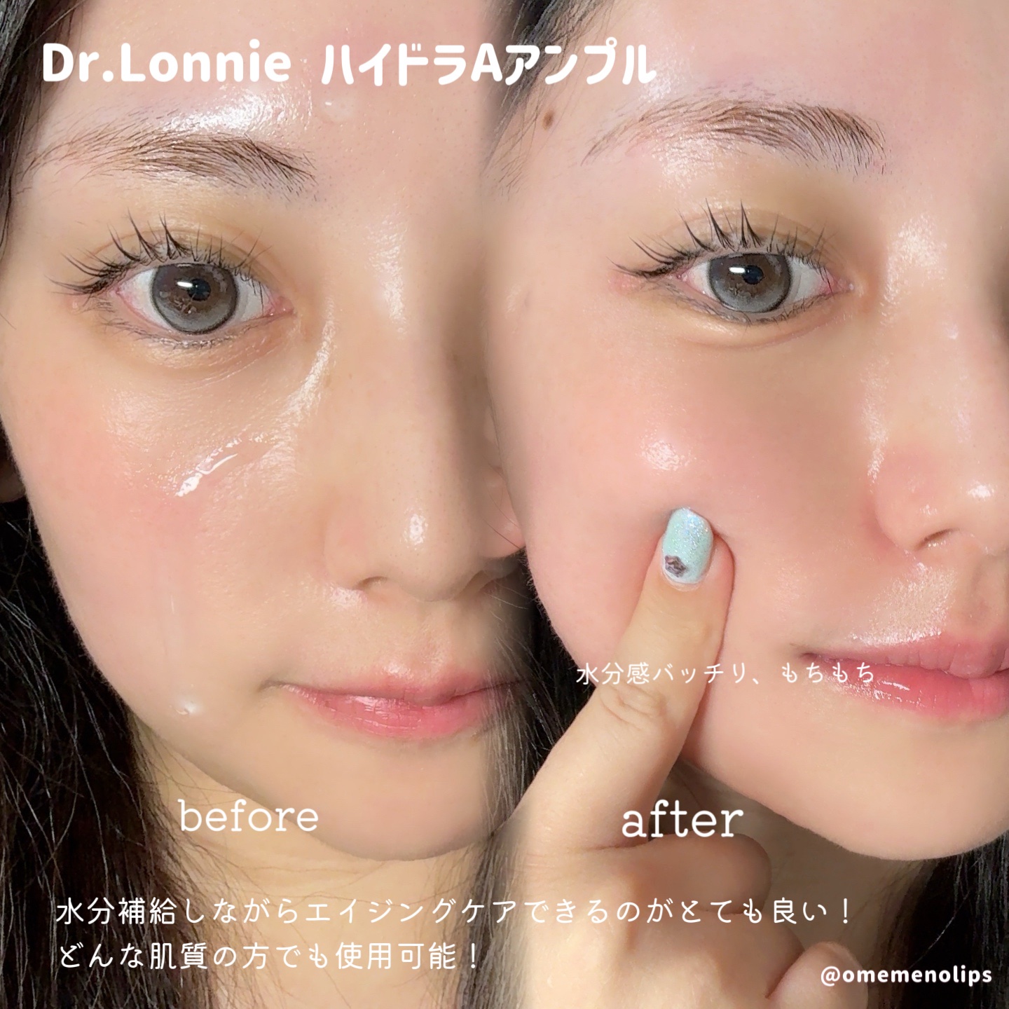 ハイドラAアンプル/Dr.lonnie/美容液を使ったクチコミ（3枚目）