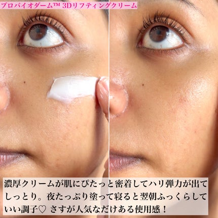 バイオヒールボ プロバイオダーム 3Dリフティングクリーム/BIOHEAL BOH/フェイスクリームを使ったクチコミ(7枚目)