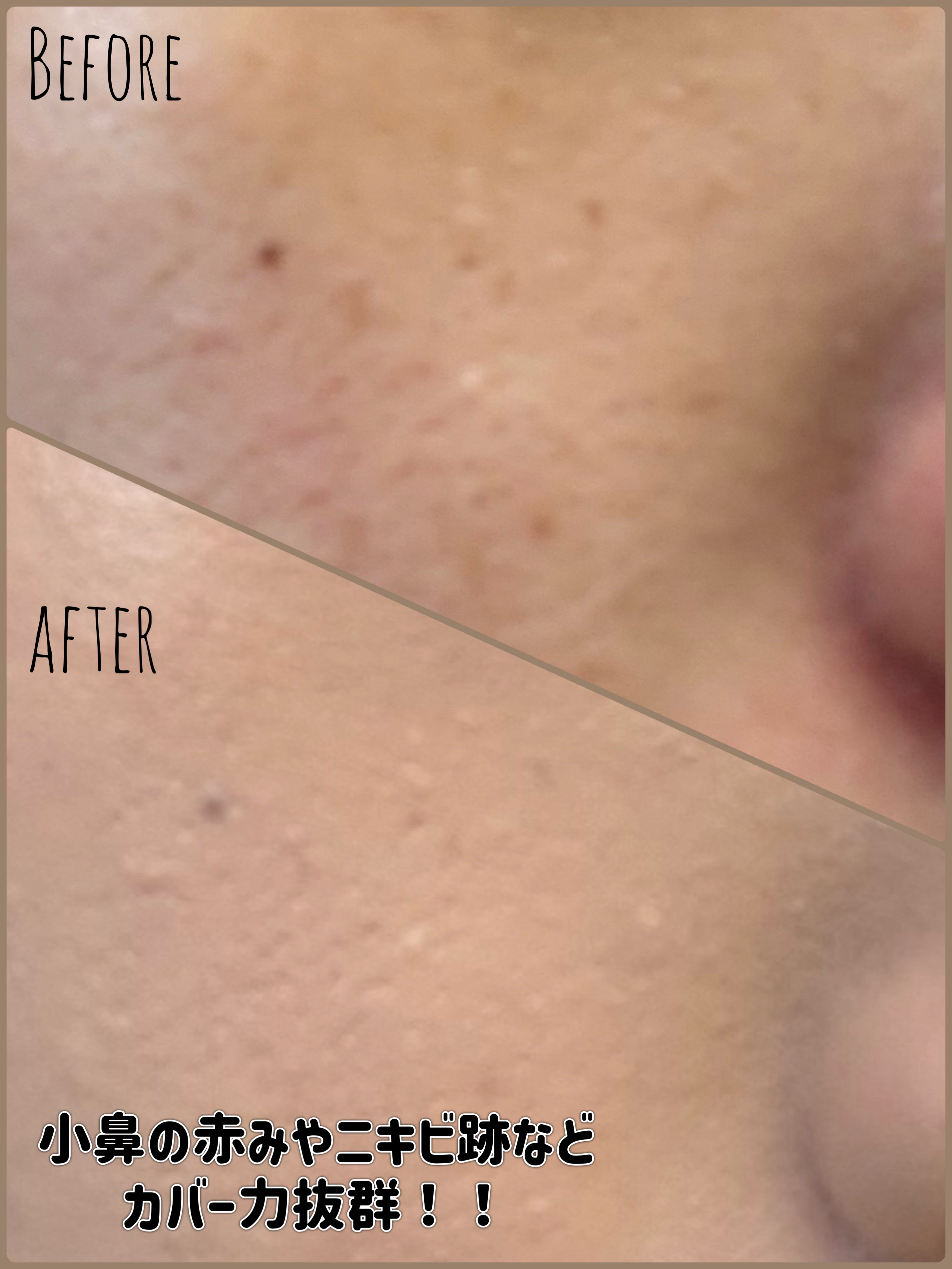 薬用カバーリキッド/クリアラスト/化粧下地を使ったクチコミ（3枚目）