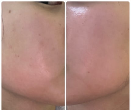 を使ったクチコミ(3枚目)