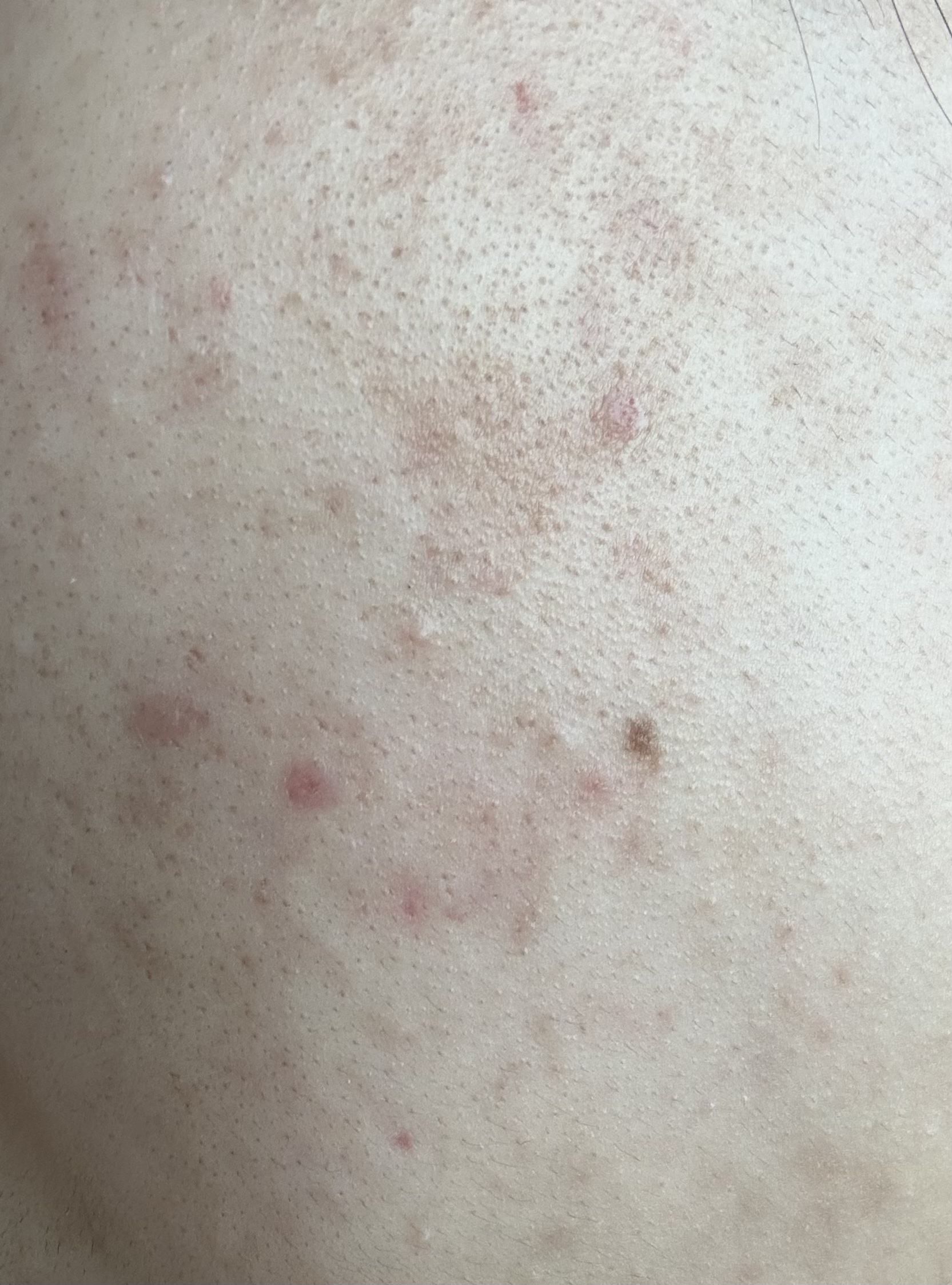 クリアフル ローションM(しっとりタイプ)/オルビス/化粧水を使ったクチコミ（1枚目）