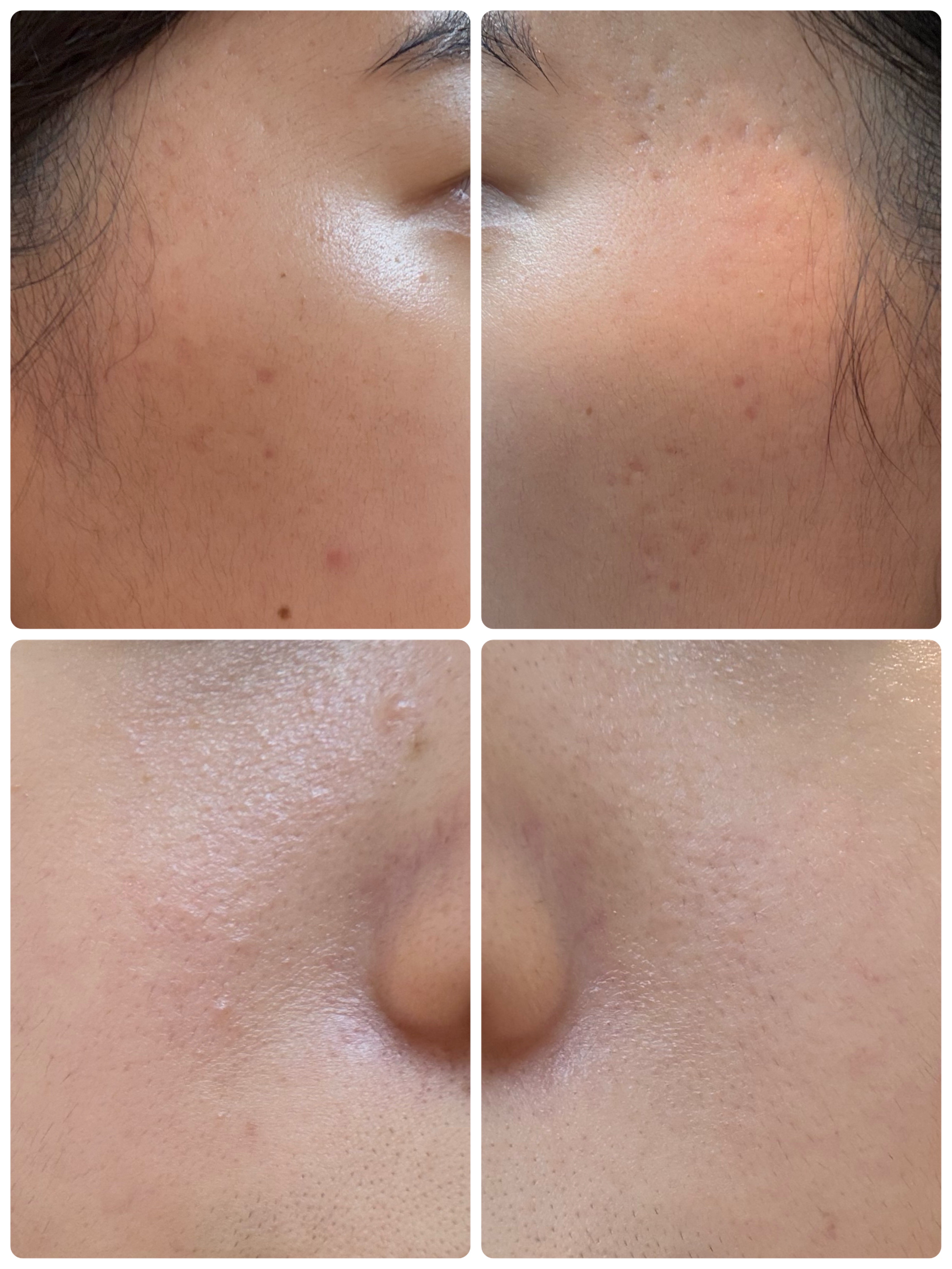 AGE-R ブースタープロ/MEDICUBE/美顔器・マッサージを使ったクチコミ（2枚目）