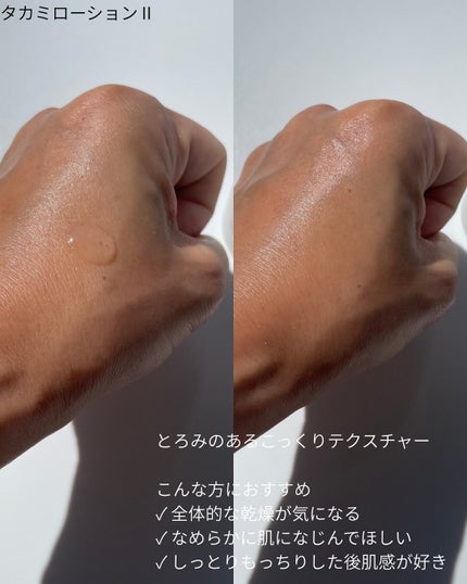 タカミスキンピール/タカミ/ブースター・導入液を使ったクチコミ(5枚目)