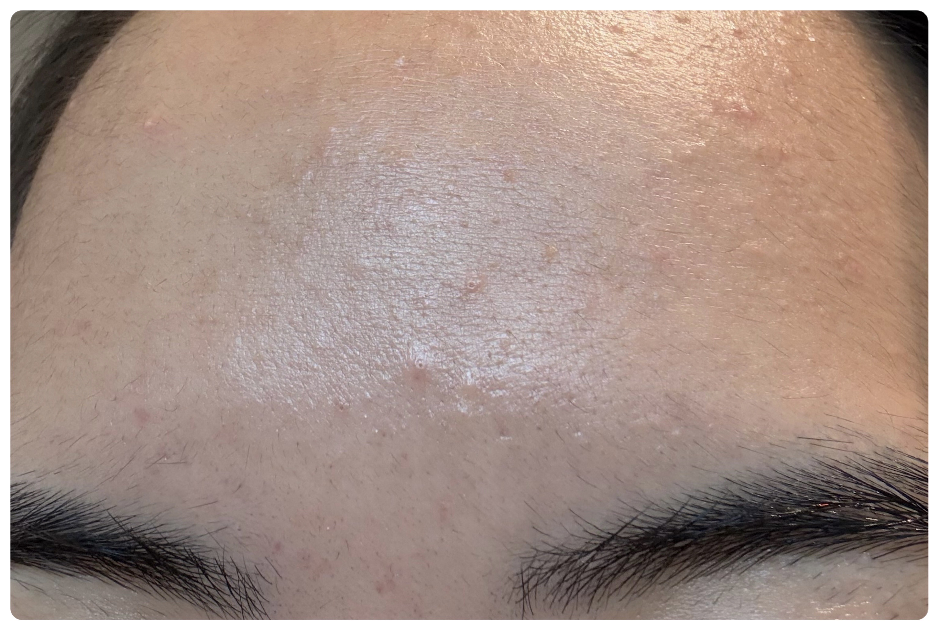 AGE-R ブースタープロ/MEDICUBE/美顔器・マッサージを使ったクチコミ（3枚目）