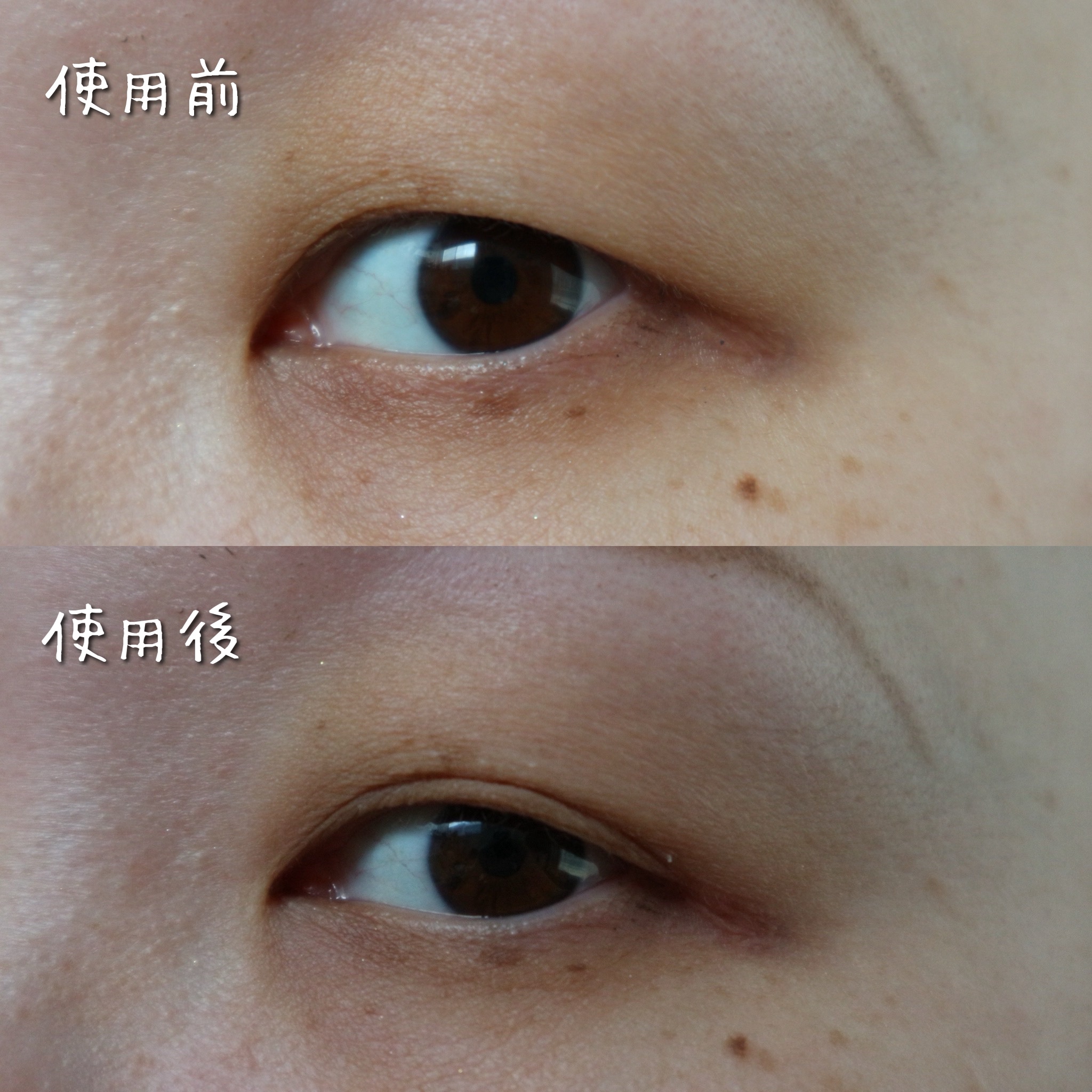 フリーファイバー120 スタンダードタイプ  120本/メザイク/二重まぶた用アイテムを使ったクチコミ（2枚目）