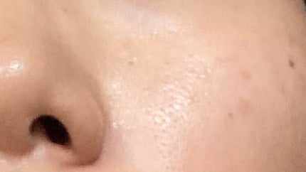 AN on LIPS 「顔洗いすぎで化粧水とかピリピリ染みてきた💦TISSのうたい文句..」(8枚目)